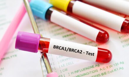 Diagnostyka molekularna raka piersi w kierunku mutacji w genach BRCA1/2