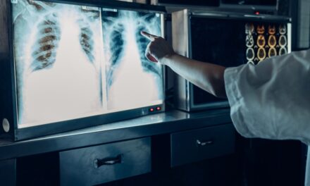 Rak płuca: ważne zmiany w&nbsp;programie lekowym B.6 od&nbsp;1 października 